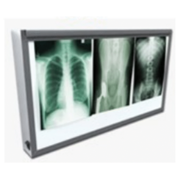 X-ray View Box